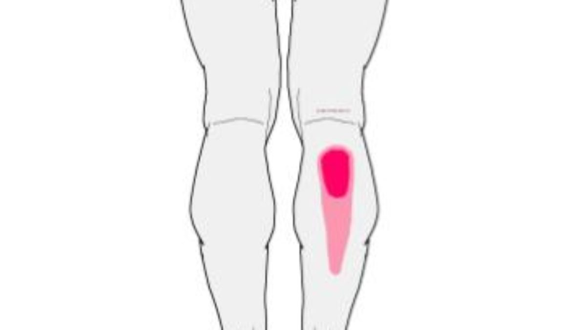 Pain in the mid-calf and heel - Integrative Works