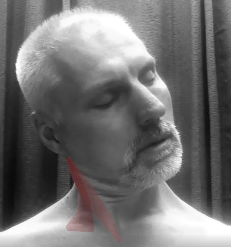 Sternocleidomastoid - Functional Anatomy - Integrative Works