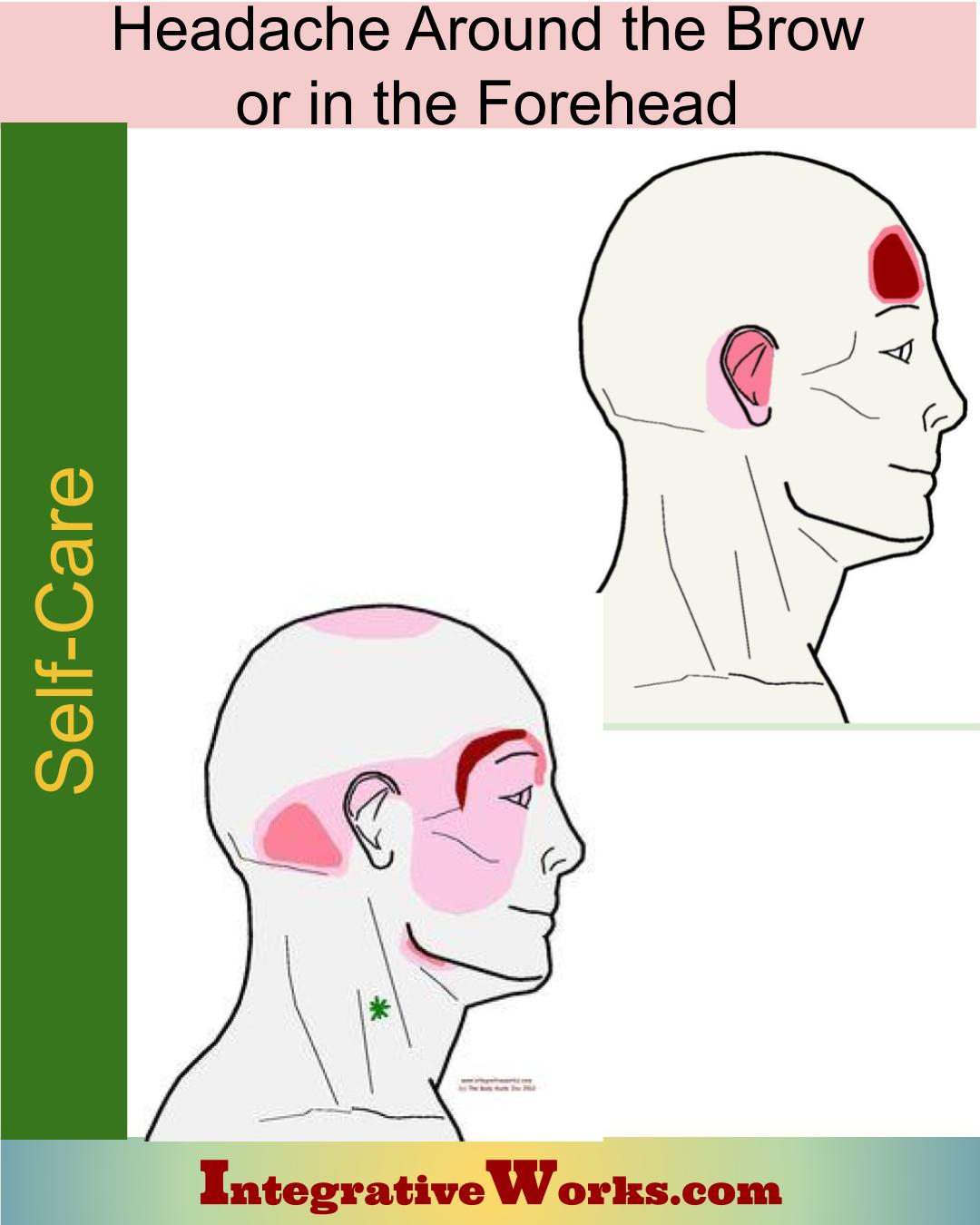 Self Care – Headache Around Brow or Forehead