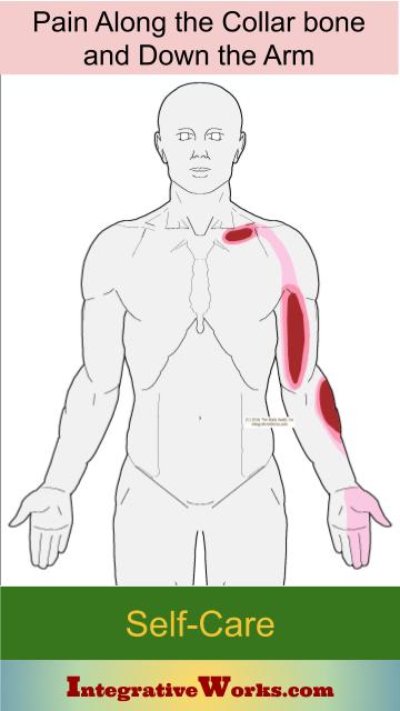 Torso into Arm: Pain Patterns, Causes, Self-Care | Integrative Works
