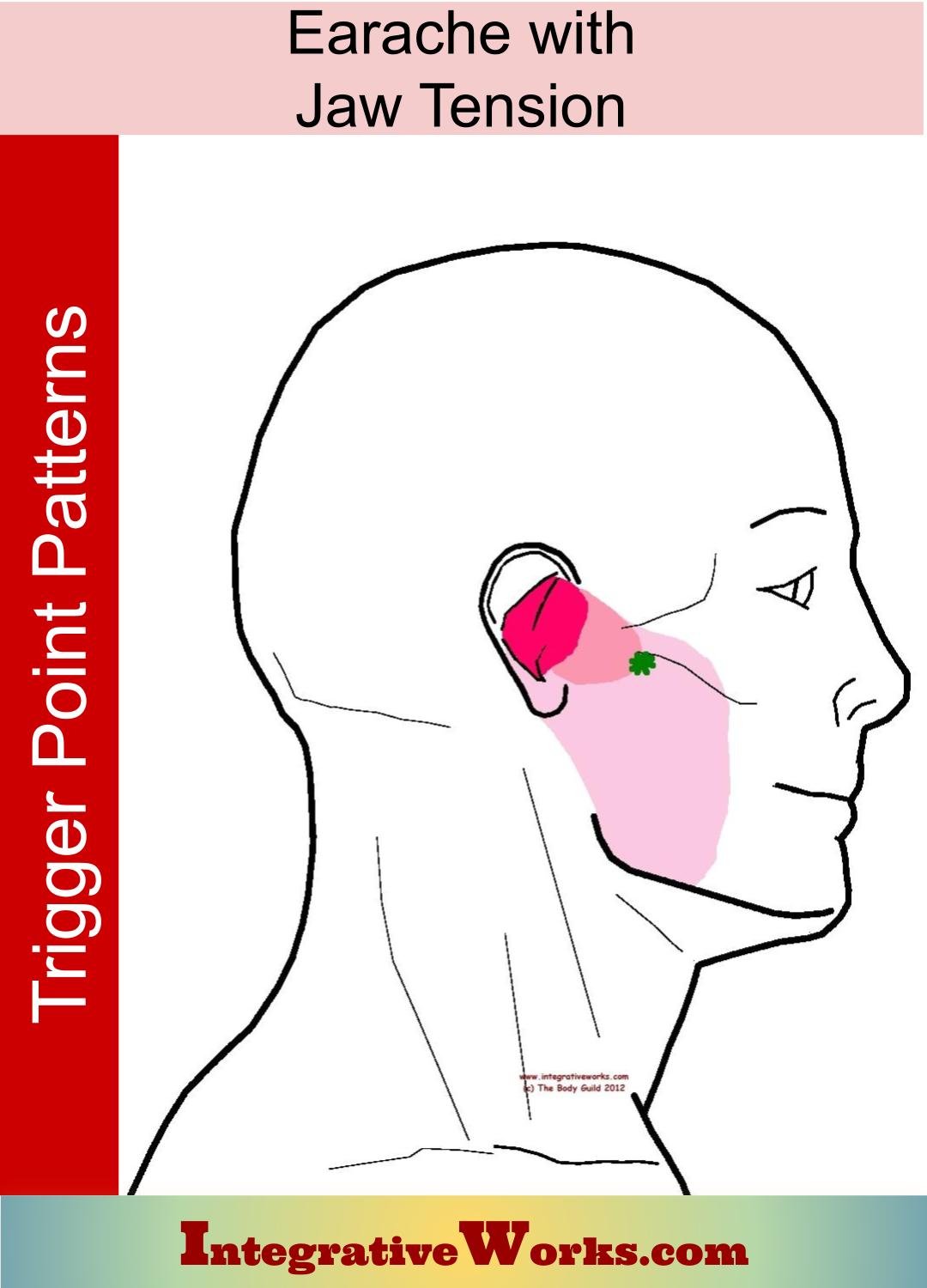 Earache with Jaw tension