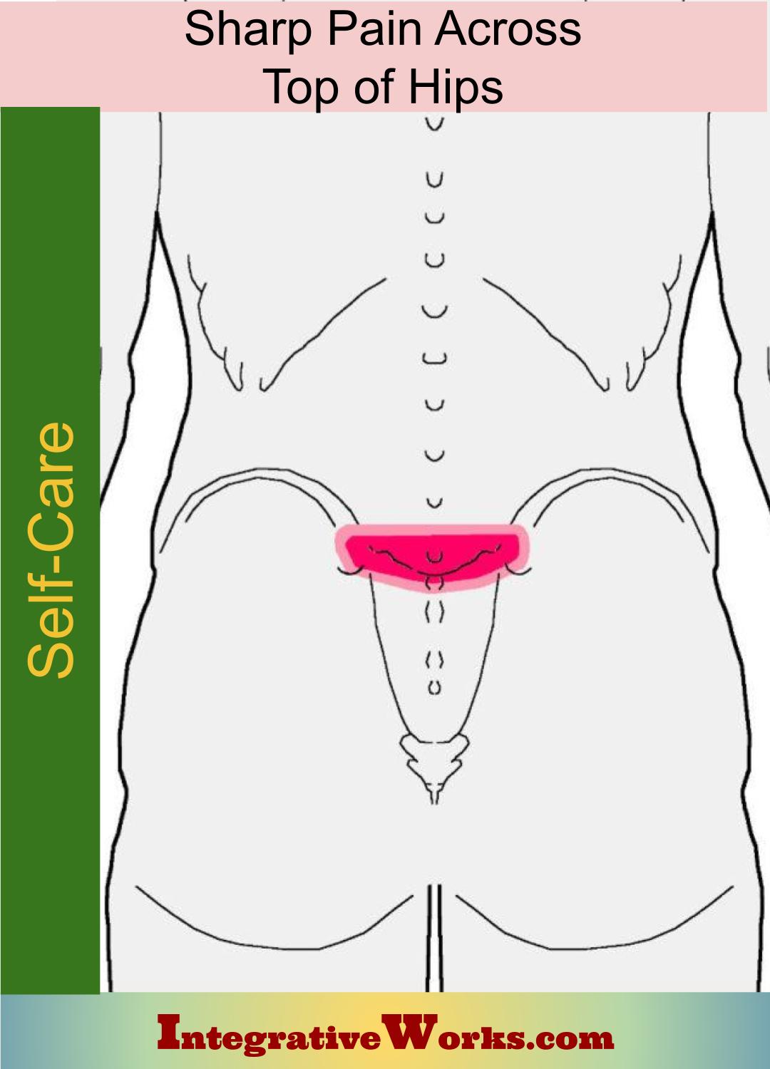 Self Care – Sharp Pain Across Top of Hips