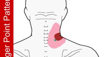 Pain at the Base of the Neck When Turning