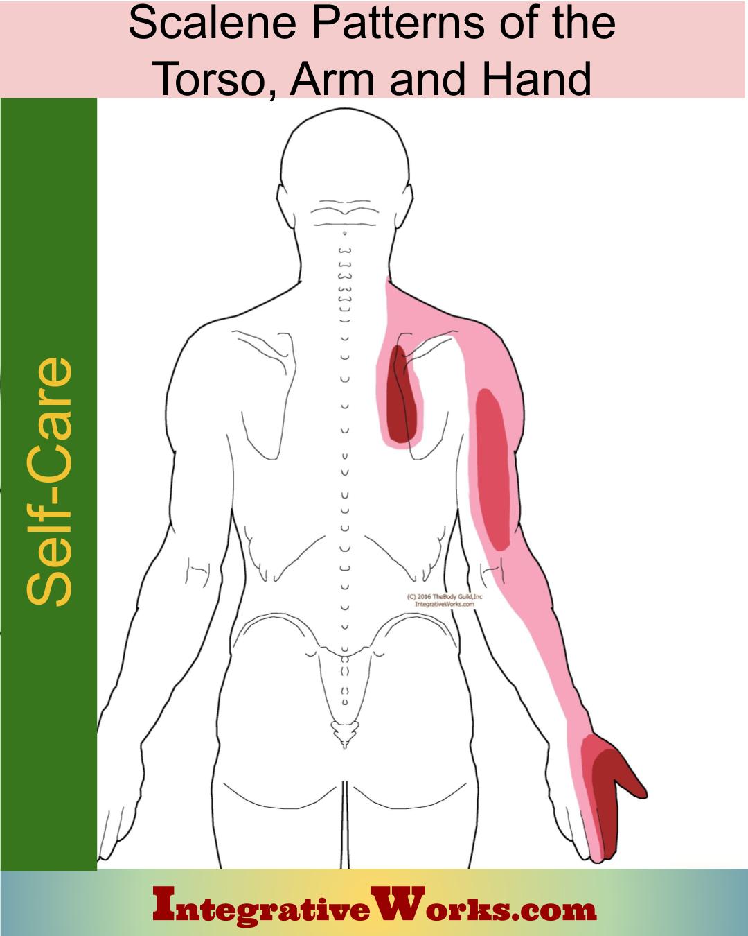 Self Care – Scalene Pain of the Torso, Arm & Hand