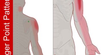 Shoulder Pain and Neck Tension in Golf Swing
