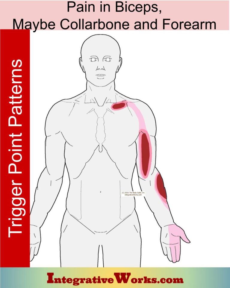 Pain Along the Biceps, Maybe Collar Bone & Forearm - Integrative Works