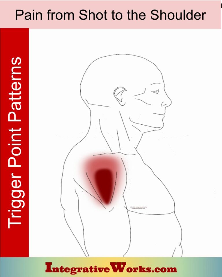 Shoulder Pain Archives - Integrative Works