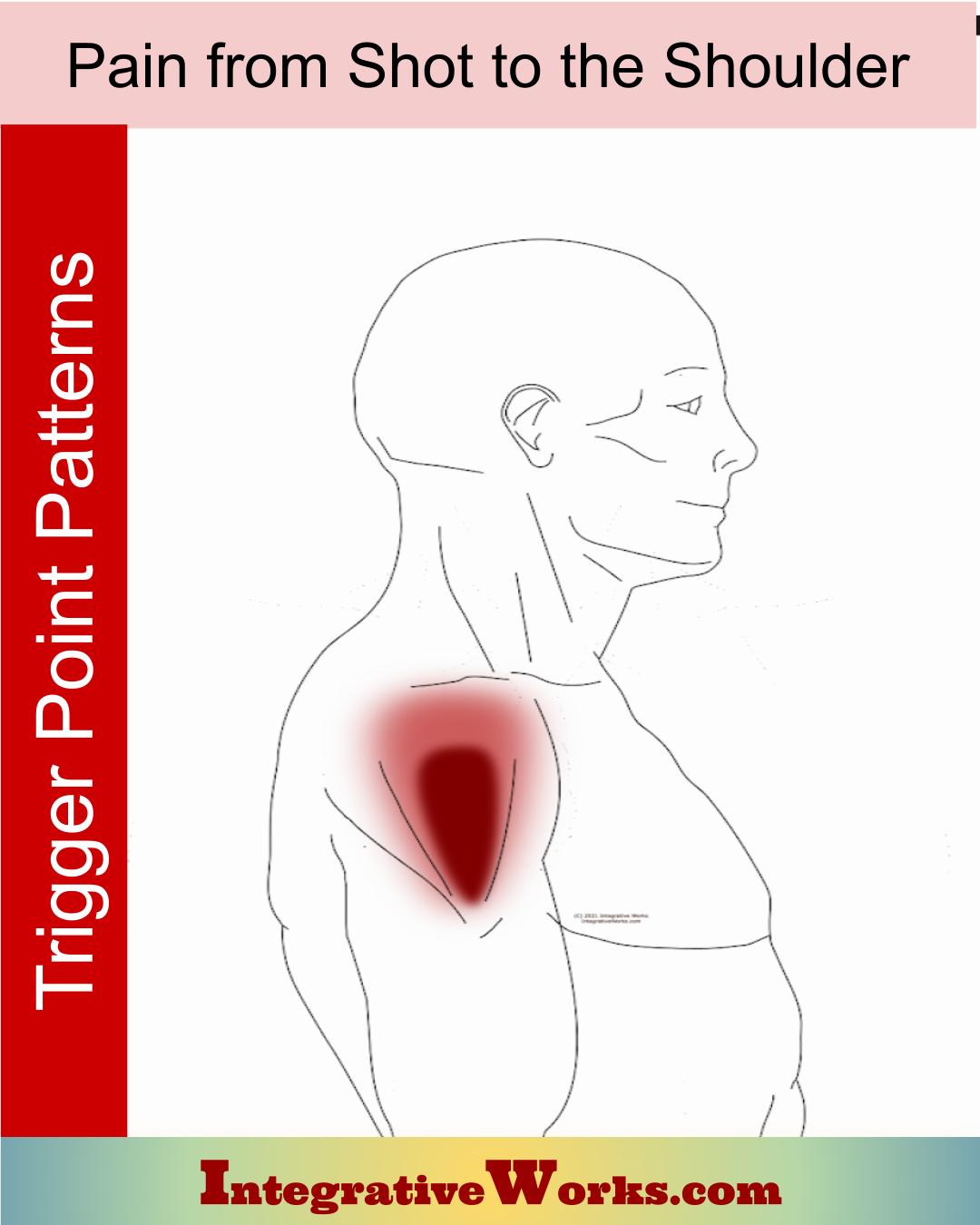 Pain After Shot to the Shoulder