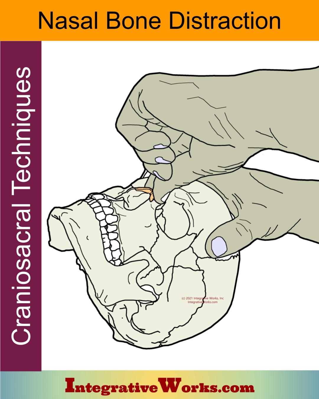 Nasal Bone Distraction – Craniosacral Technique