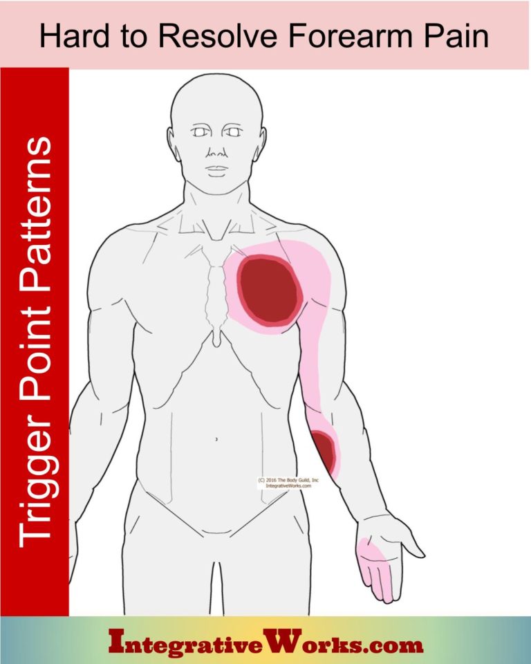 Hard to Resolve Forearm Pain - Integrative Works