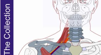 Thoracic Outlet Syndrome: Pain Patterns, Causes, Self-Care