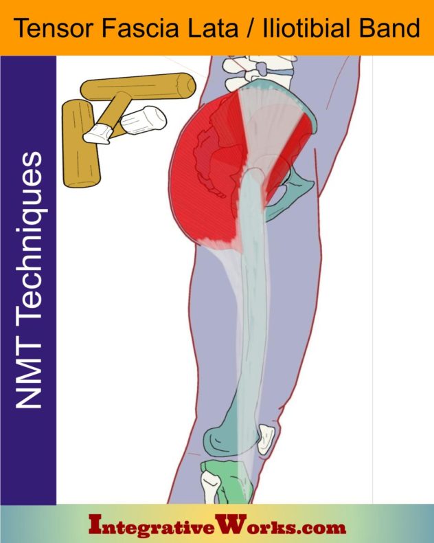 Tensor Fascia Lata - Neuromuscular Massage Protocol - Integrative Works