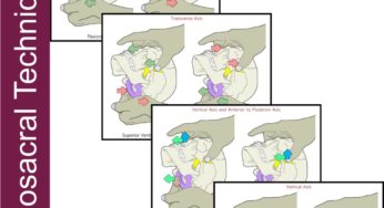 Craniosacral SBS Patterns – Walkthrough