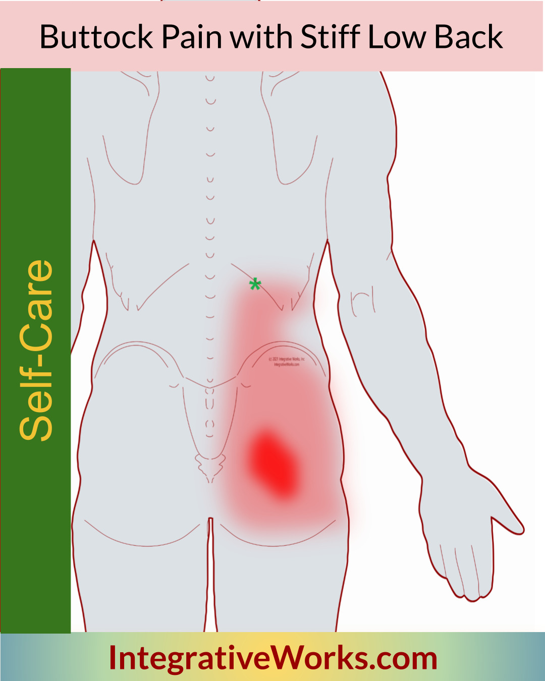 Self-Care – Buttock Pain with Stiff Low-Back