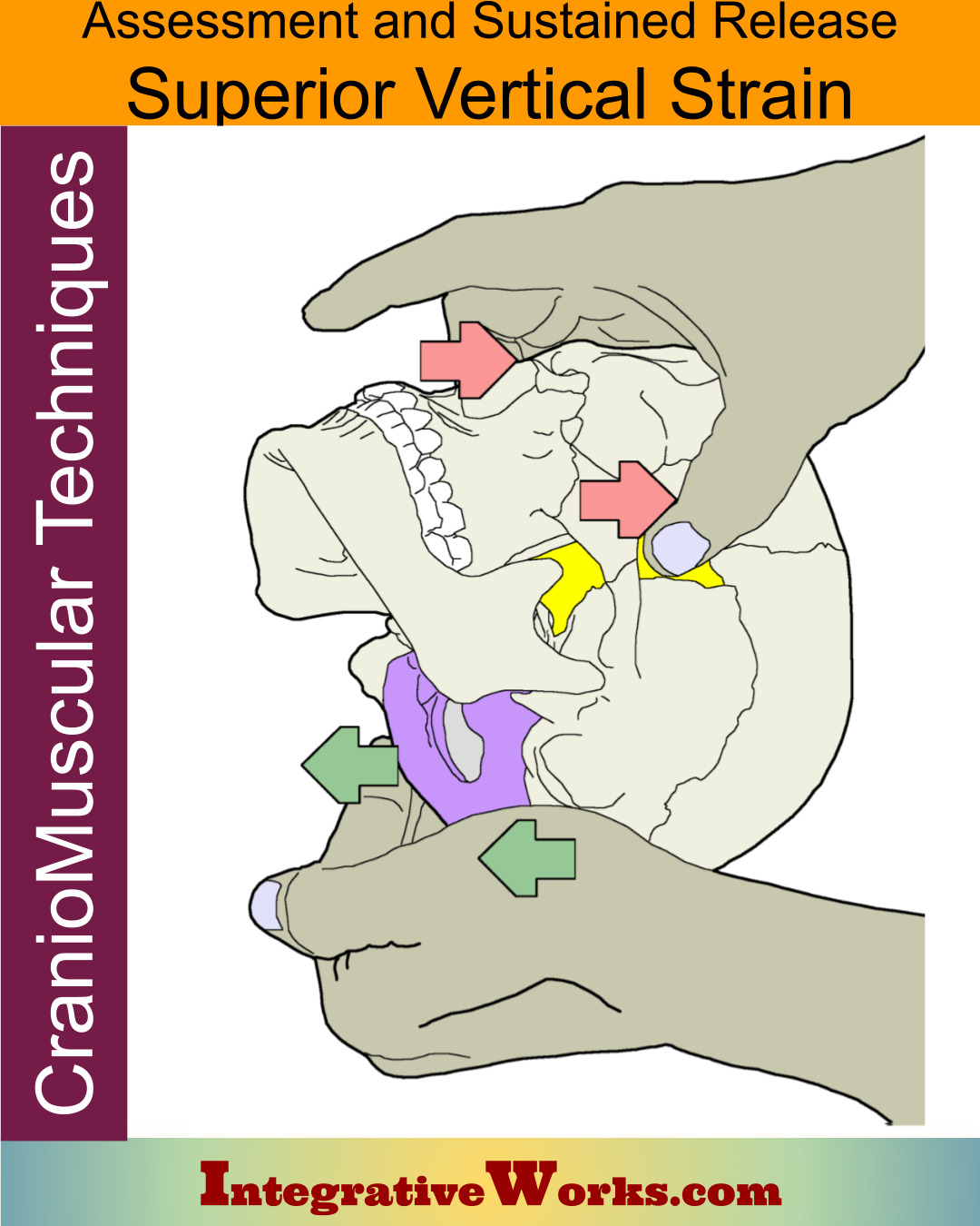 CranioMuscular – Superior Vertical Strain
