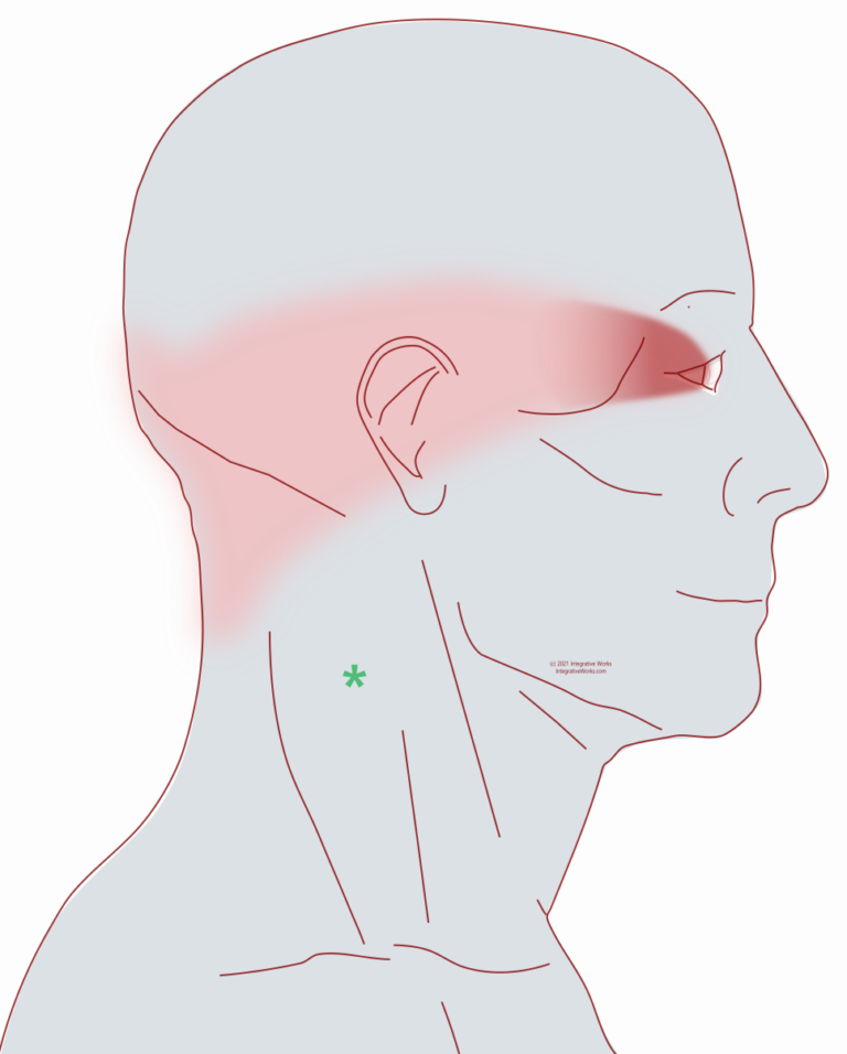 Neck-ache Headache, Eye-ache - Integrative Works