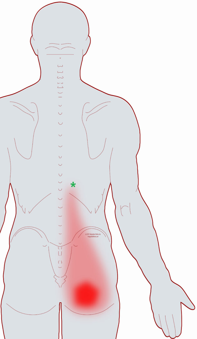 Self-Care - Buttock Pain with Tightness in the Back - Integrative Works