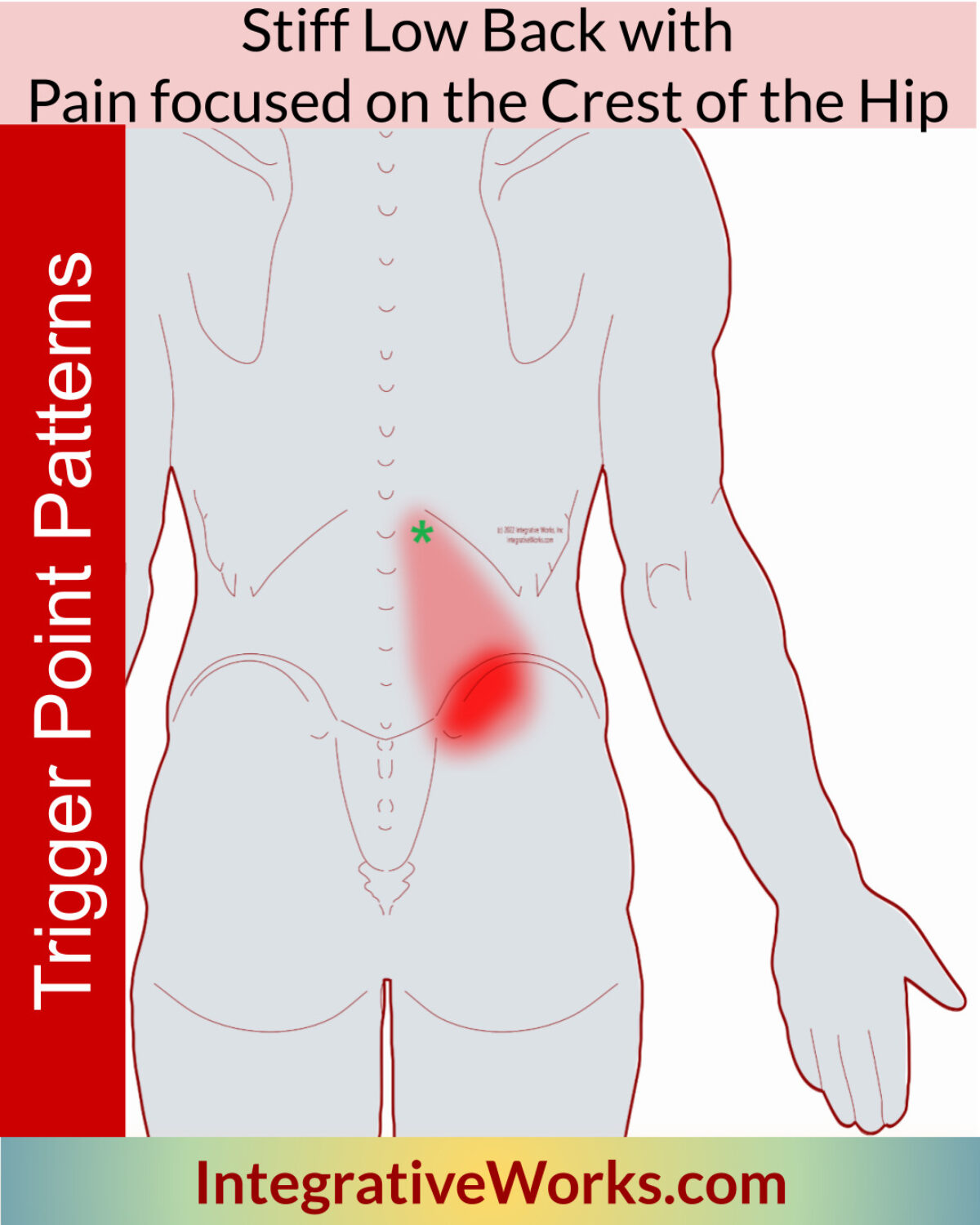 Understanding the Low Back Pain Trigger Points