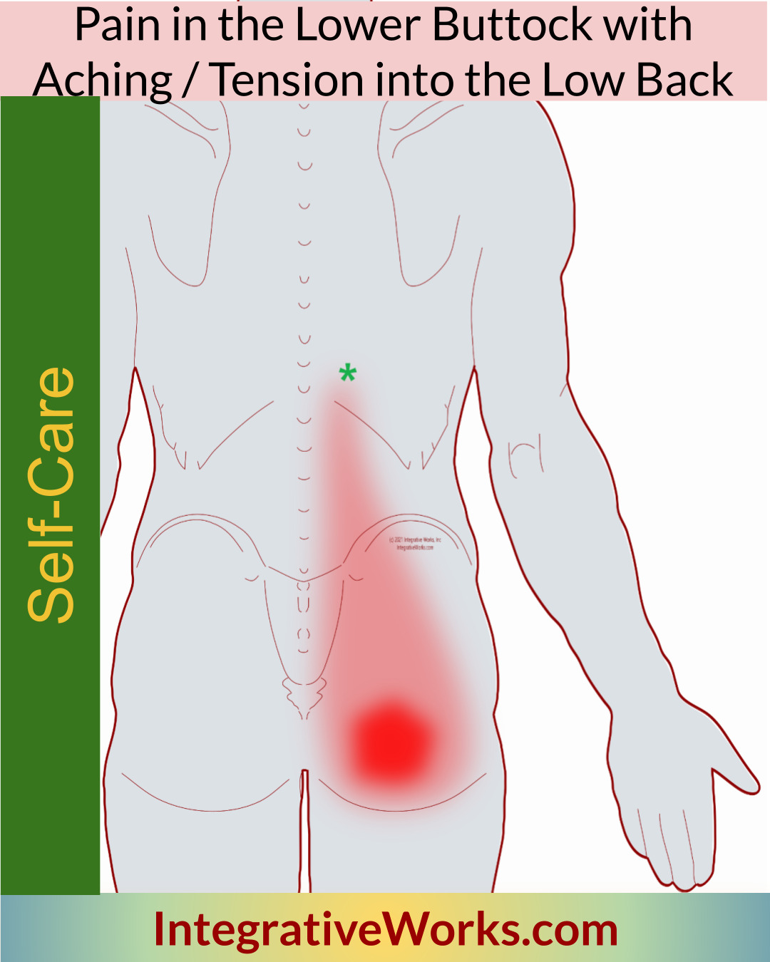 Self-Care – Buttock Pain with Tightness in the Back