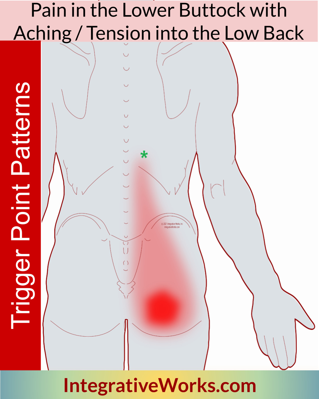 Buttock Pain with Tightness into the Back