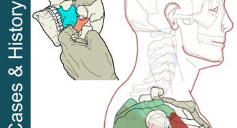 Mystery Shoulder Pain – Craniosacral Relief
