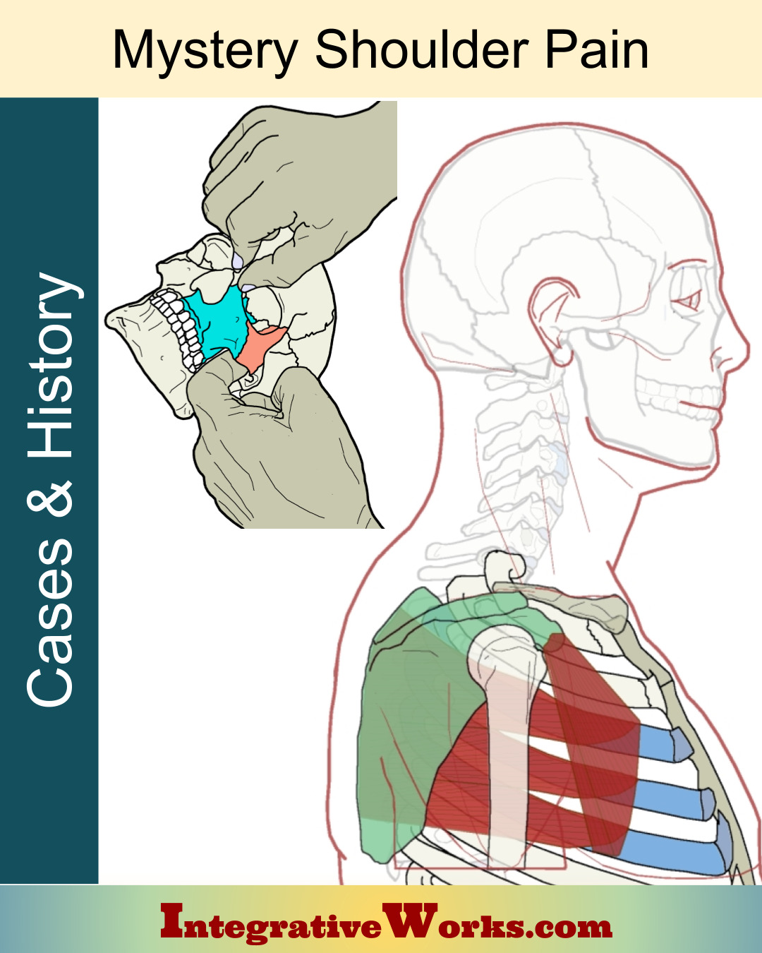 Mystery Shoulder Pain – Craniosacral Relief