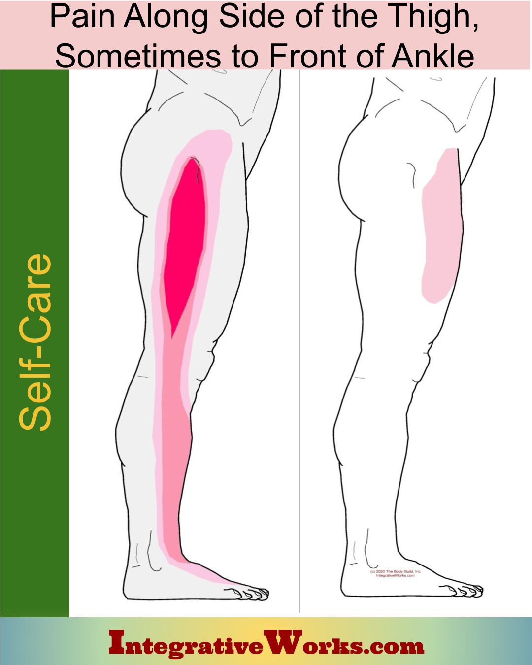 Self Care – Tensor Fascia Lata – Pain or tingling along side of the thigh