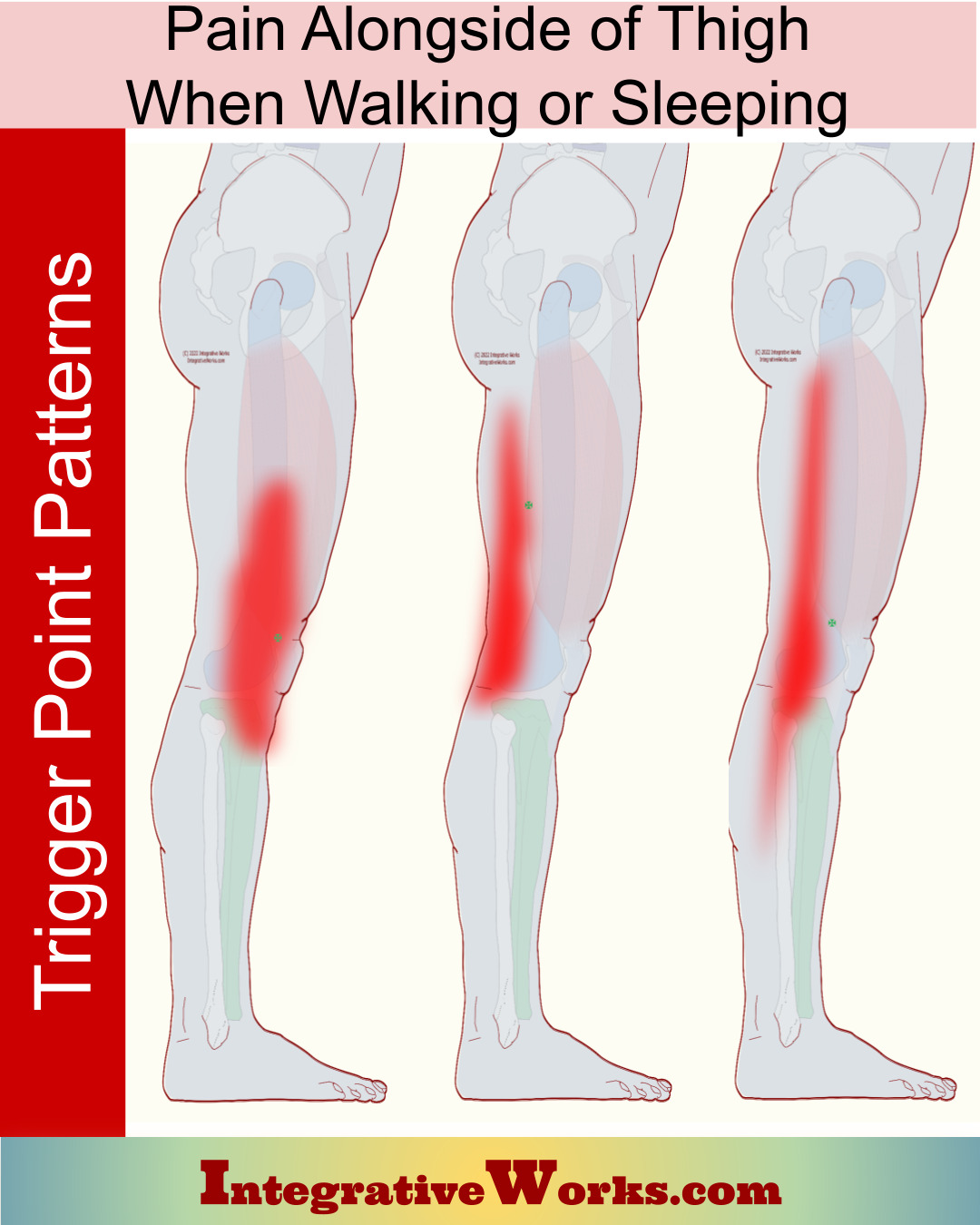 Pain Alongside of Thigh when Walking or Sleeping