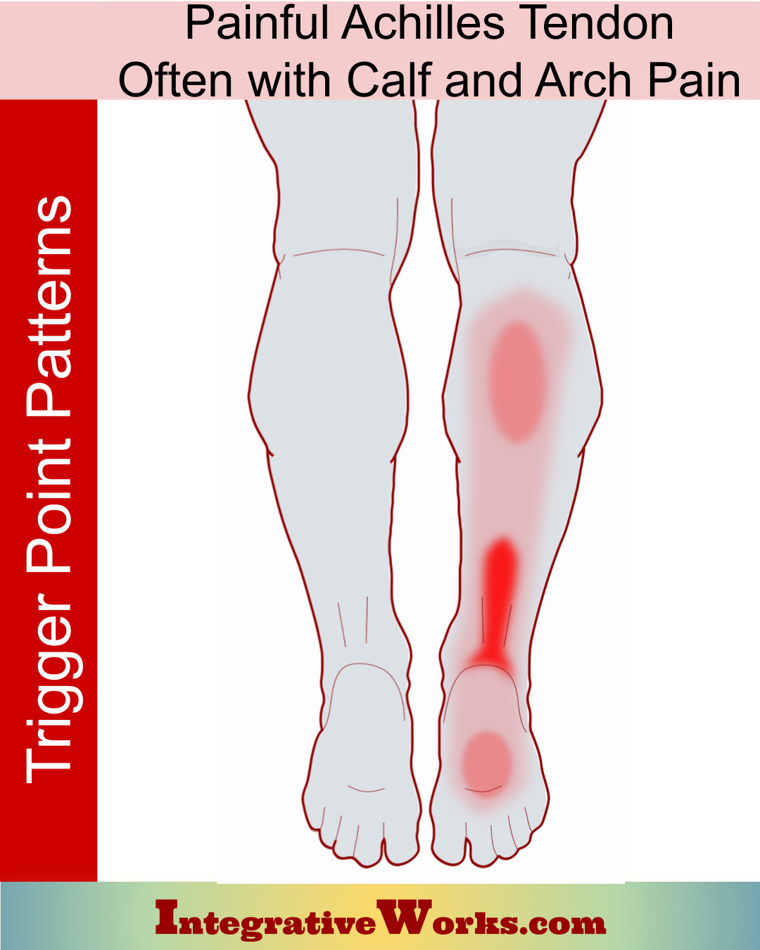 Pain in the Achilles Tendon