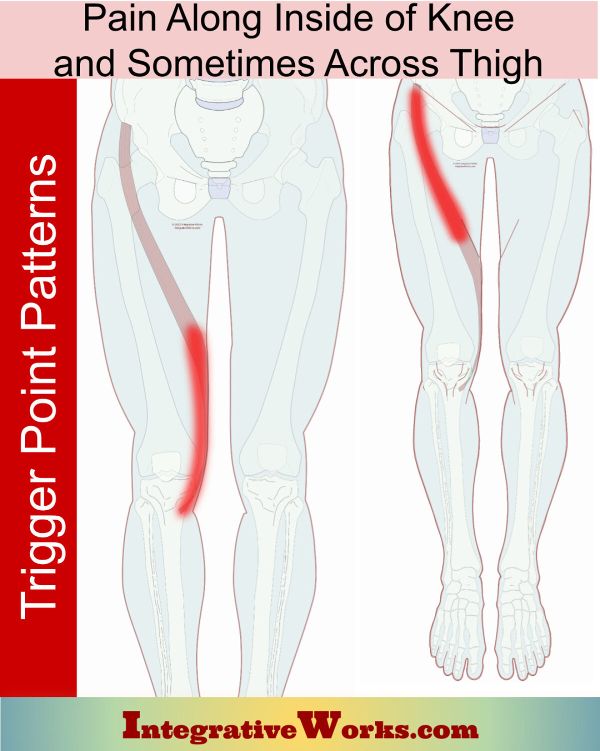 Pain Inside Knee. Sometimes Across Thigh - Integrative Works