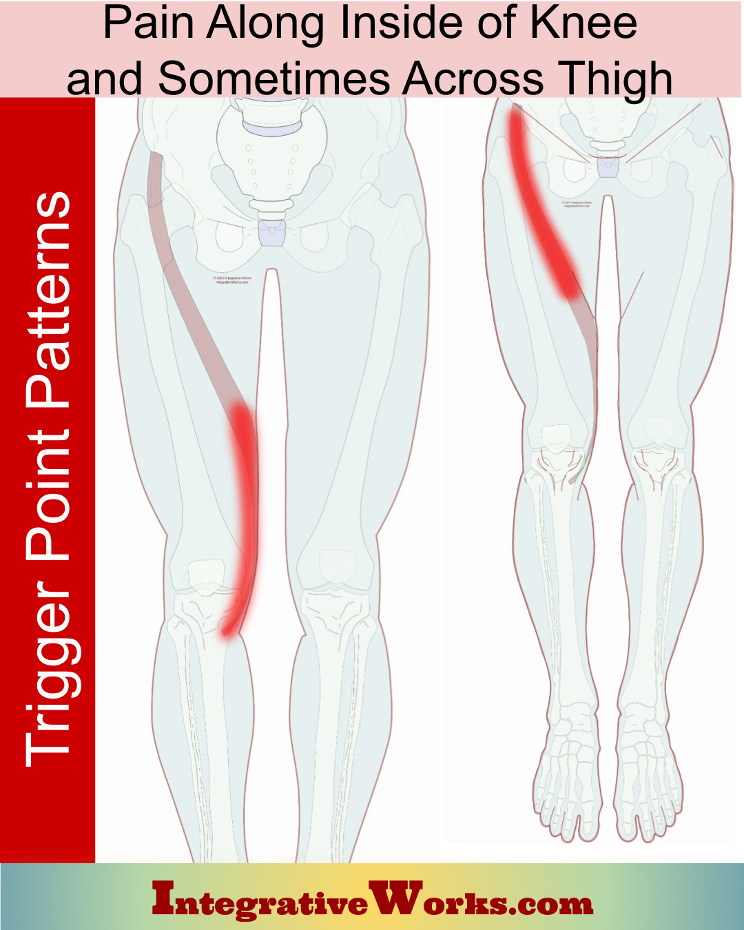 Pain Inside Knee. Sometimes Across Thigh Integrative Works