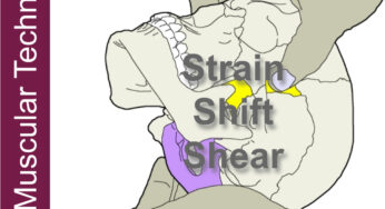 SBS – Strain, Right Shift and Shear