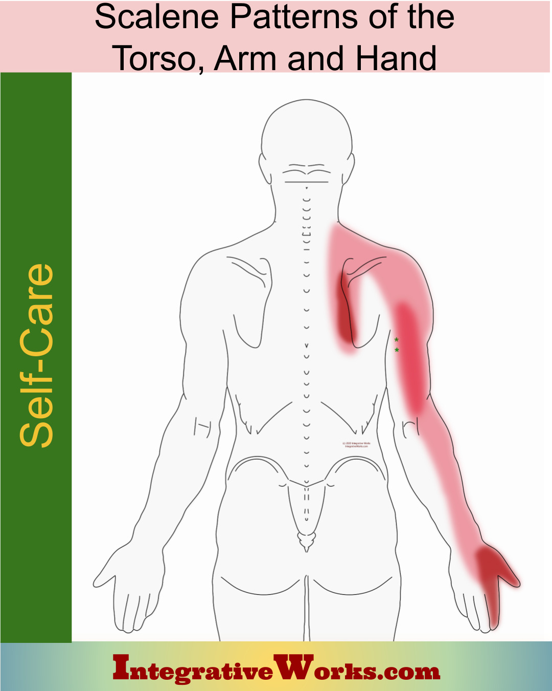 Self Care – Scalene Pain of Upper Back, Arm & Hand