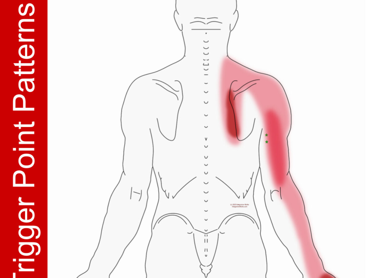 Pain in the upper back, index finger, and thumb - Integrative Works