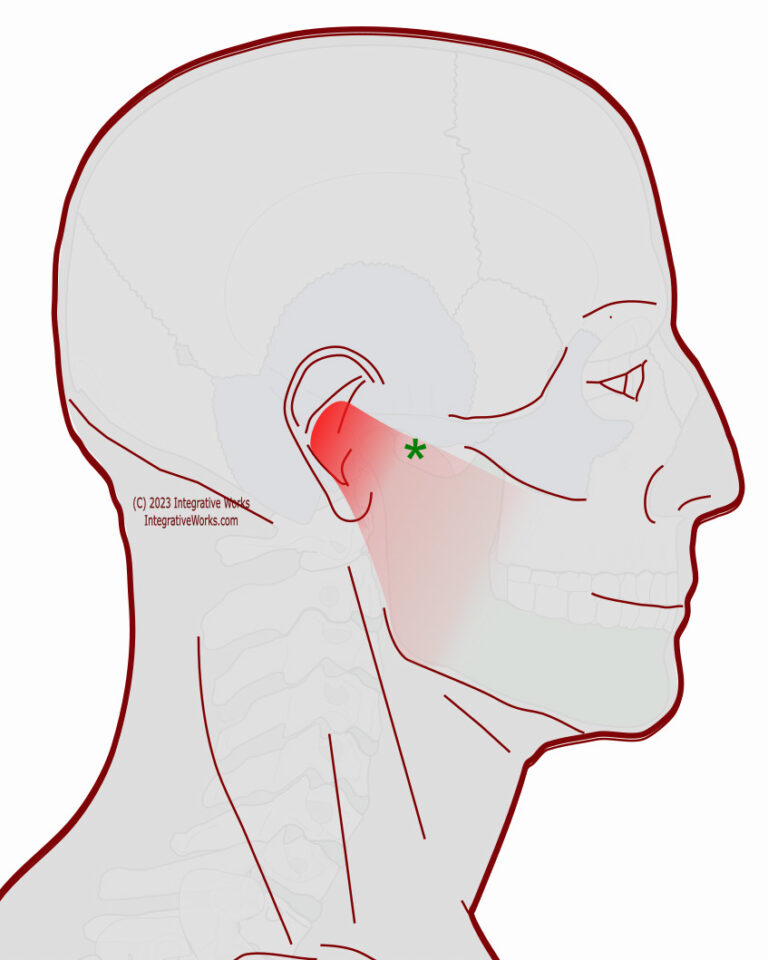 Earache with Jaw tension - Integrative Works