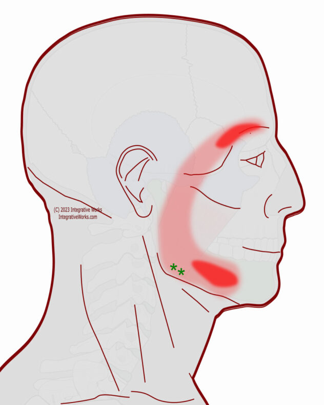 Headache In The Eyebrow Integrative Works