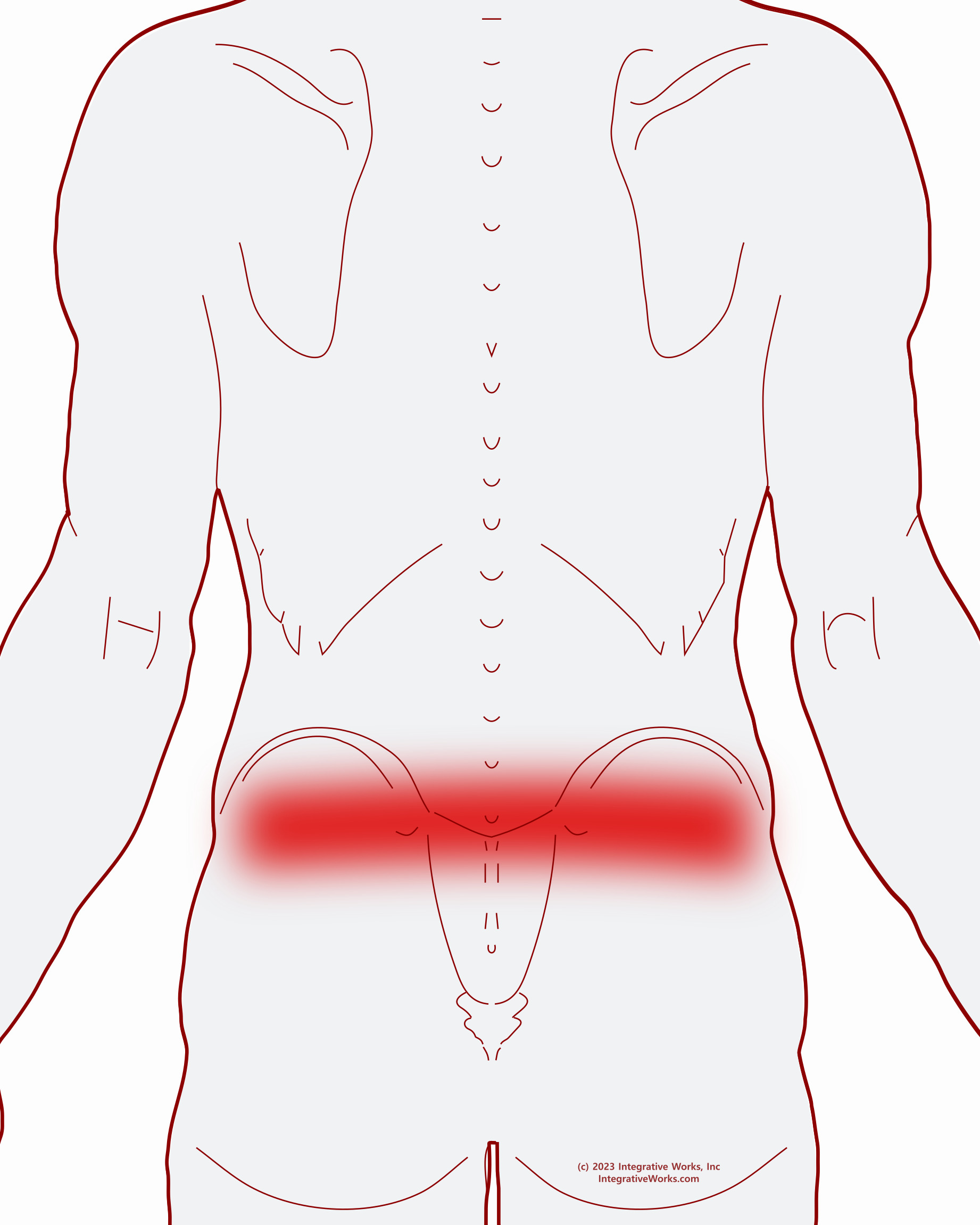 Wide Band of Pain Across the Top of the Hips - Integrative Works