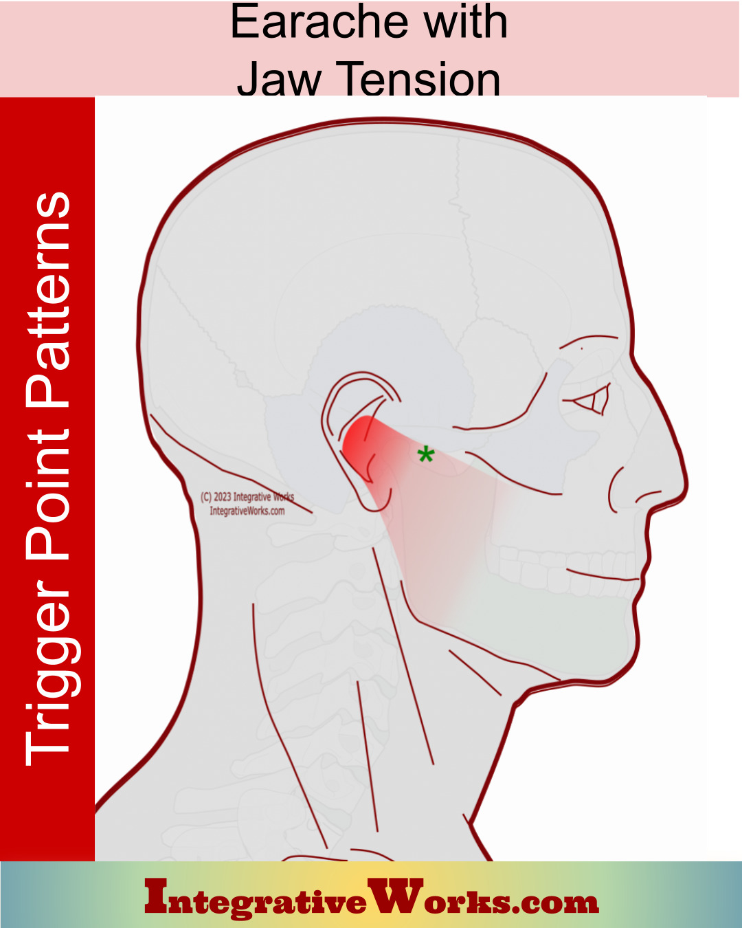Earache with Jaw tension