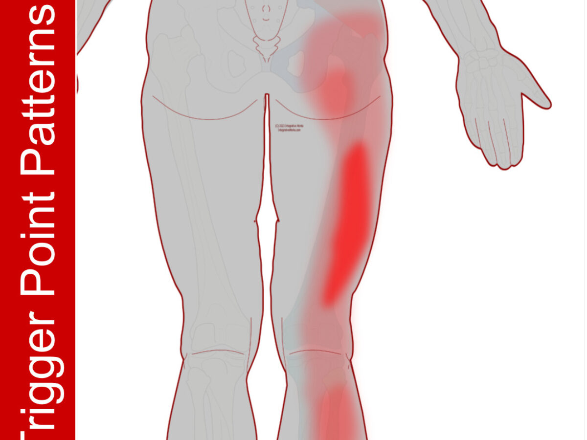 Outer thigh trigger points hot sale