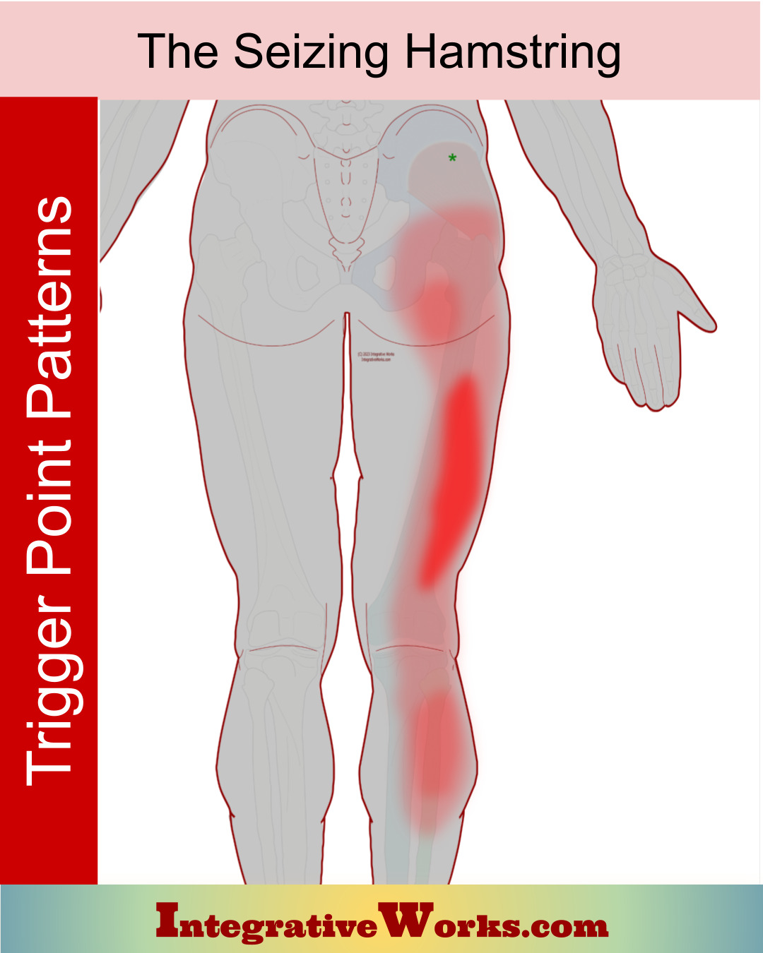 Trigger Points and The Cramping Hamstring - Integrative Works