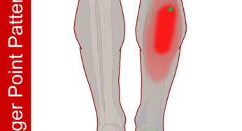 Pain Center of the Calf