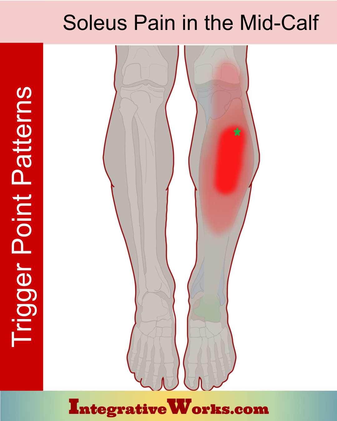 Pain Center Of The Calf Integrative Works